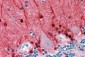 Goat Anti-Amphiphysin / AMPH Antibody